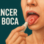 Entendendo o Câncer Oral em Santa Catarina: Guia Completo para Prevenção e Diagnóstico Precoce